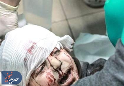 جنگ با کودکان | کودک کشی هنوز در غزه تداوم دارد
